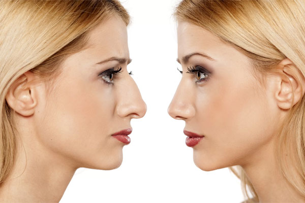 بهترین جراح بینی